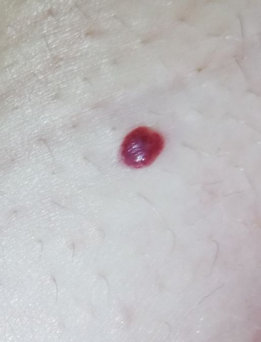 Red mole